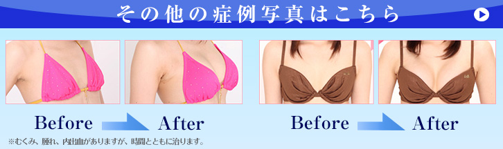 その他の症例写真