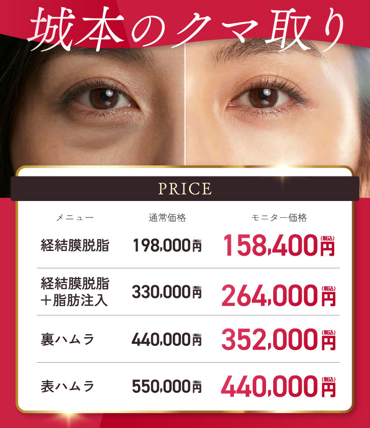 城本クリニック 目の下のクマ治療