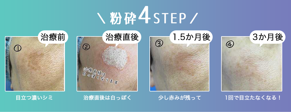 粉砕4STEP