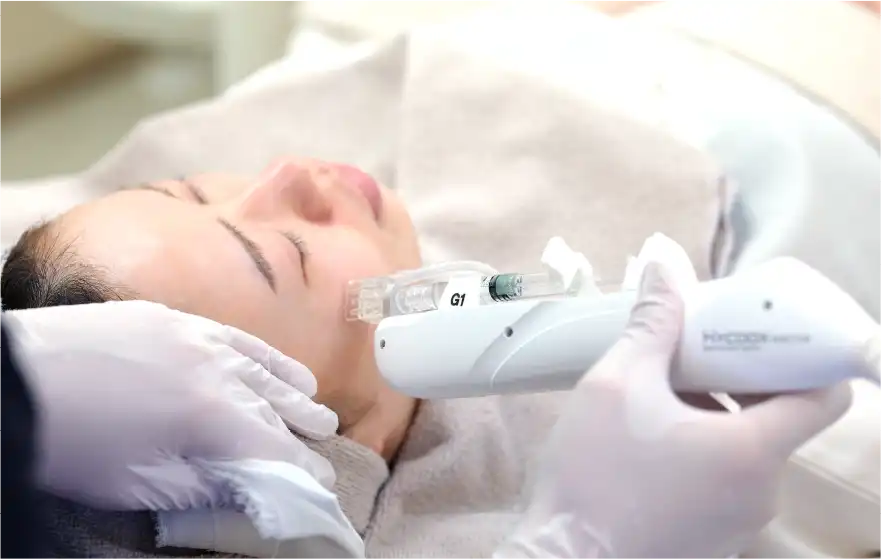 水光注射(機械による注入)