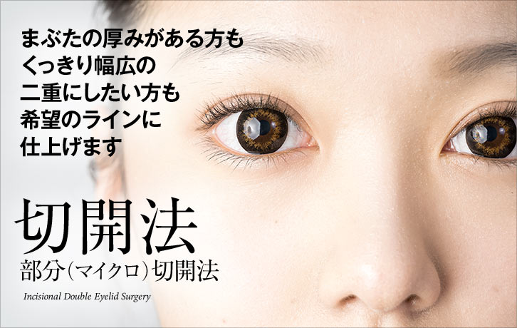 切開法・部分（マイクロ）切開法