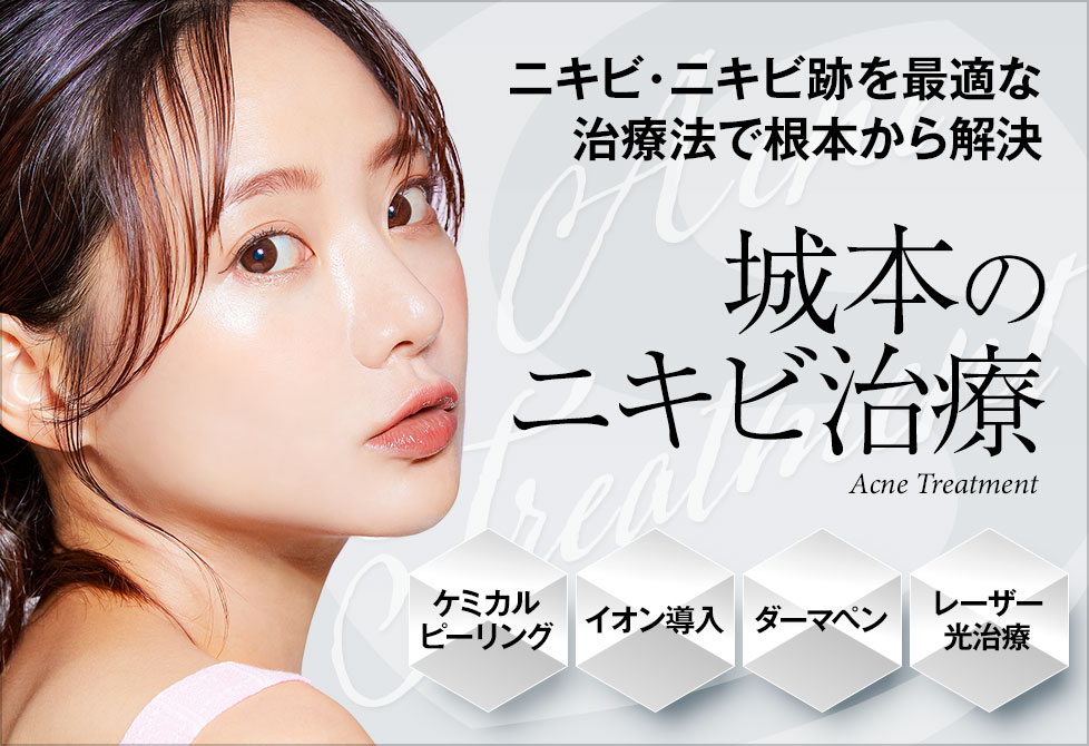 城本のニキビ治療